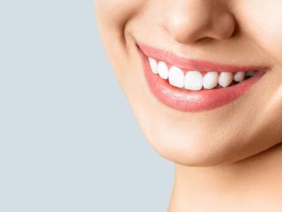 sorriso donna denti bianchi
