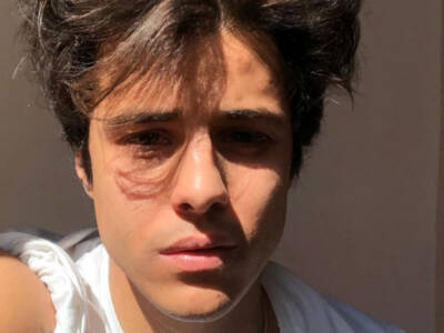 Michele Merlo