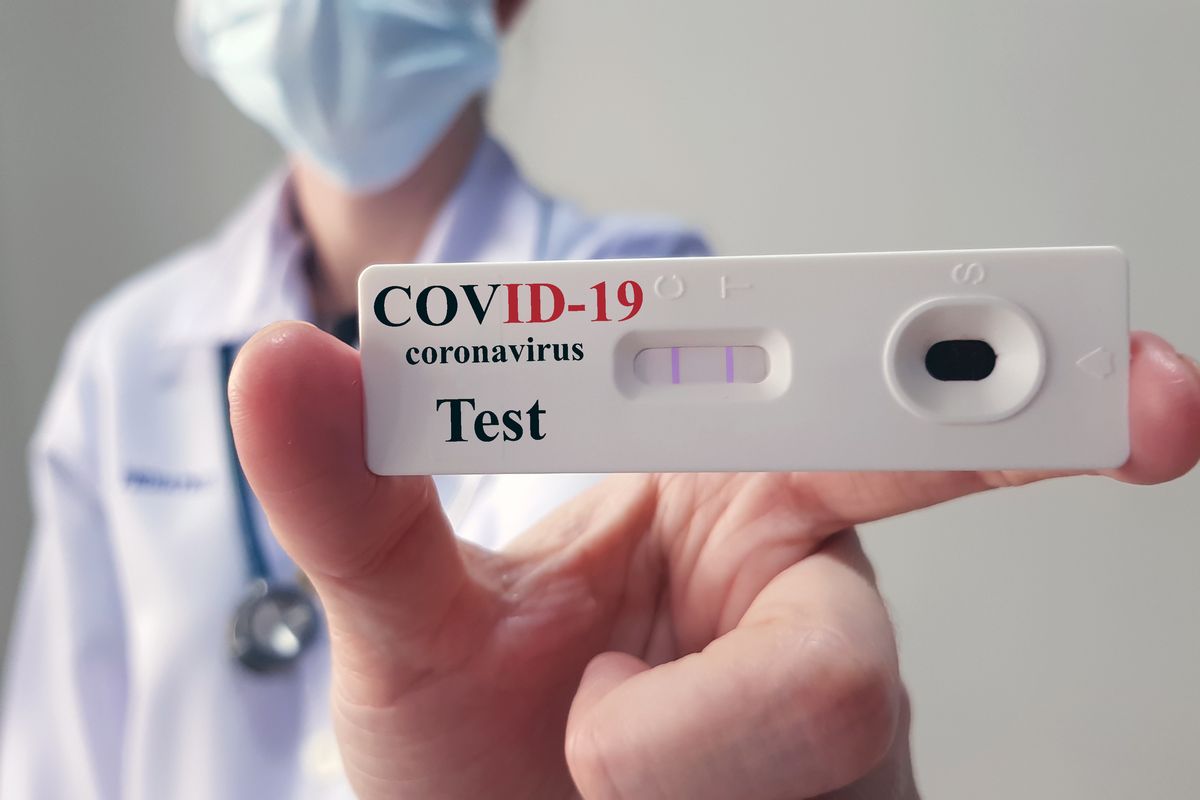 test covid positivo